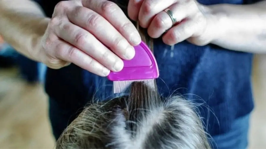 5 tips to treat head lice